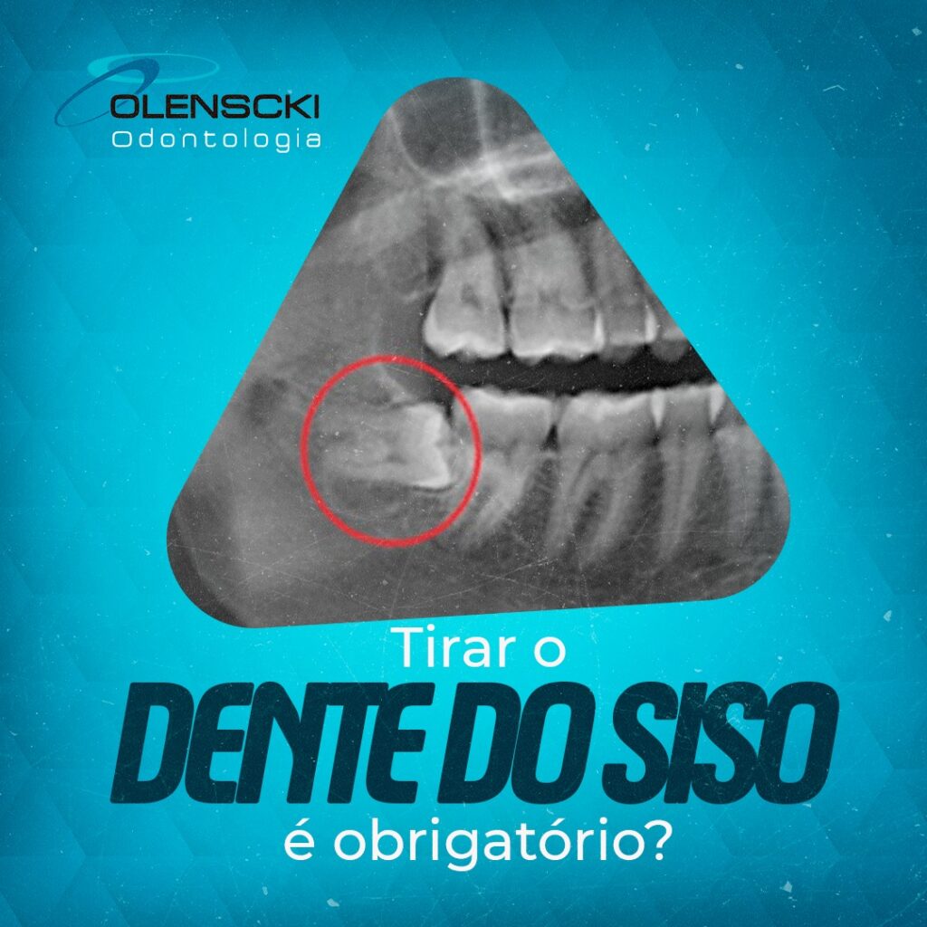 Tirar o dente do siso é obrigatório – Olenscki Odontologia